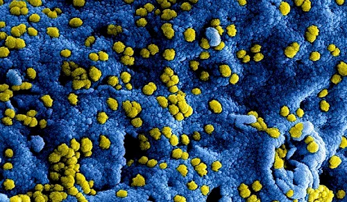 Afbeelding: Coronavirus (nieuw_coronavirus_in_china.jpg)